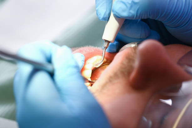 Best Emergency Treatment for Oral Infections in Blue Rapids, KS